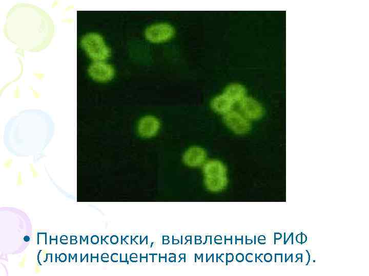  • Пневмококки, выявленные РИФ (люминесцентная микроскопия). 