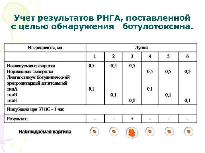 Учет результатов РНГА, поставленной с целью обнаружения ботулотоксина. 