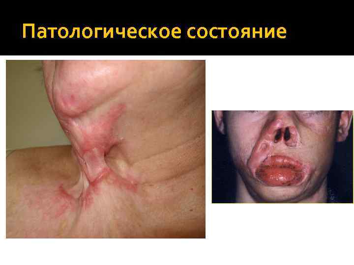 Патологическое состояние 