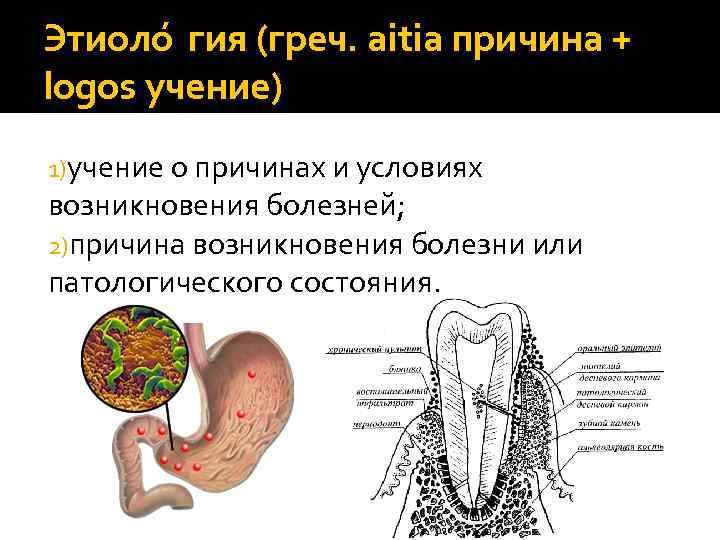 Этиоло гия (греч. aitia причина + logos учение) 1)учение о причинах и условиях возникновения