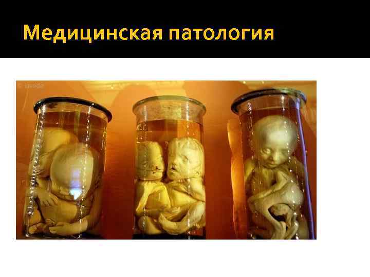 Медицинская патология 