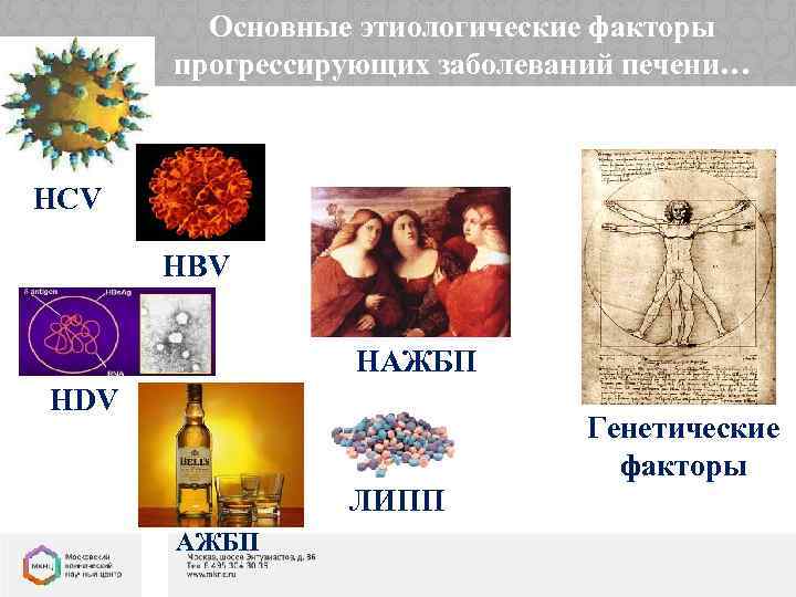 Основные этиологические факторы прогрессирующих заболеваний печени… HCV HВV НАЖБП HDV Генетические факторы ЛИПП АЖБП