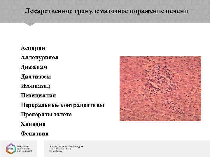 Лекарственное гранулематозное поражение печени Аспирин Аллопуринол Диазепам Дилтиазем Изониазид Пенициллин Пероральные контрацептивы Препараты золота