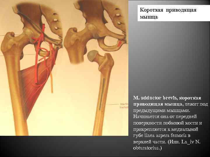 Adductor Brevis мышца