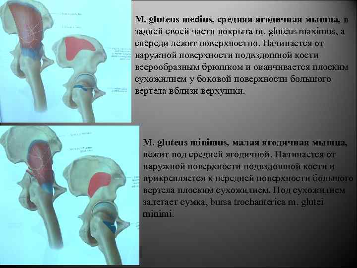 M. gluteus medius, средняя ягодичная мышца, в задней своей части покрыта m. gluteus maximus,