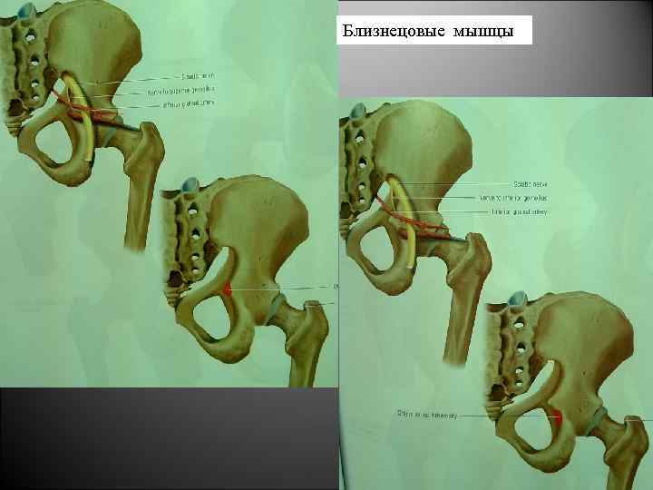 Близнецовые мышцы 