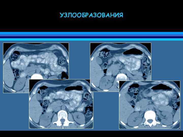 УЗЛООБРАЗОВАНИЯ 