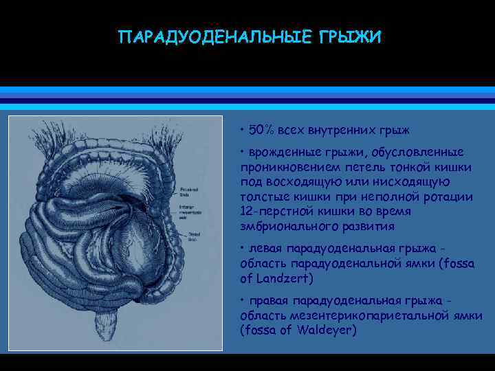 Эмбриональные грыжи презентация