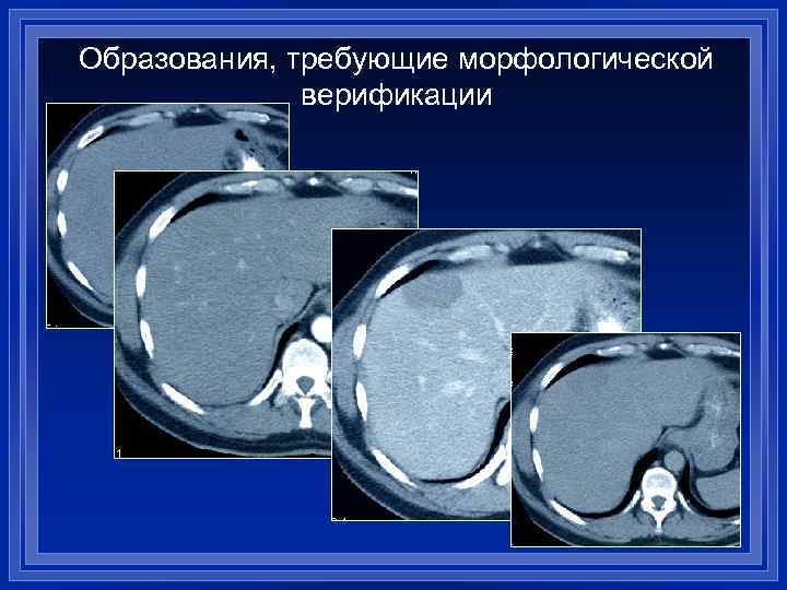 Образования, требующие морфологической верификации 