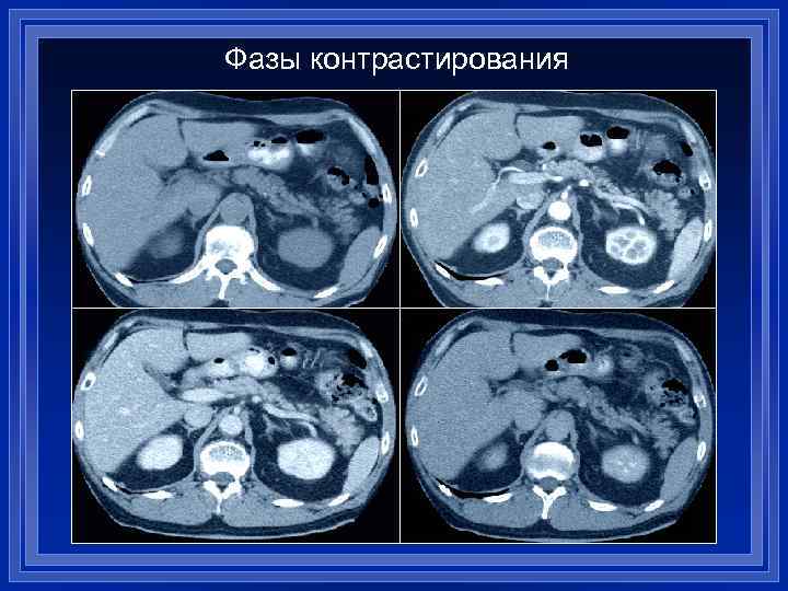 Фазы контрастирования 