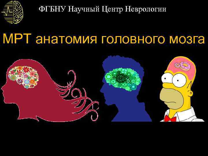 ФГБНУ Научный Центр Неврологии МРТ анатомия головного мозга 