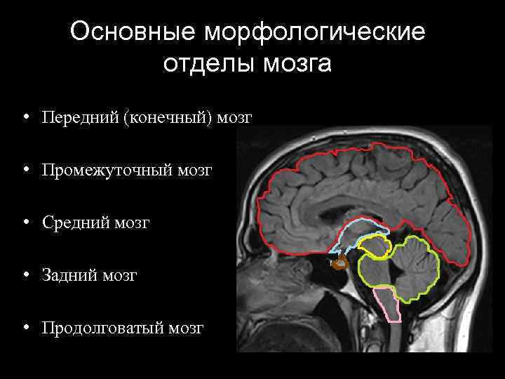 Основные морфологические отделы мозга • Передний (конечный) мозг • Промежуточный мозг • Средний мозг