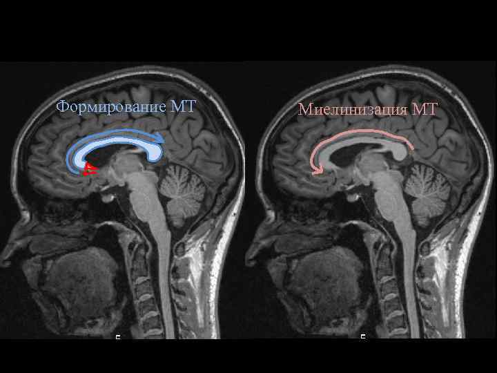 Мрт анатомия головного мозга человека thumbnail
