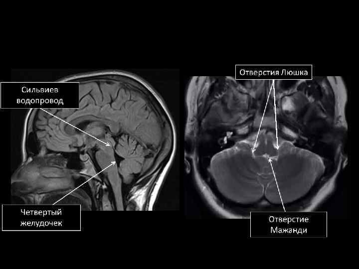 Мрт анатомия головного мозга презентация