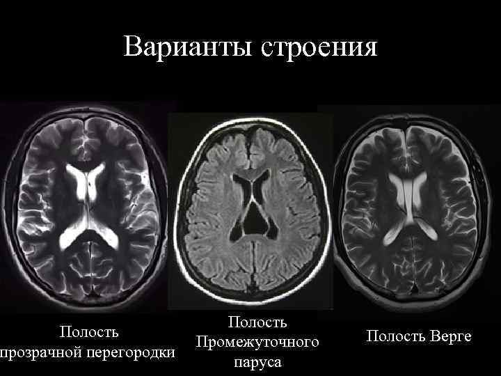 Мрт анатомия головного мозга презентация thumbnail