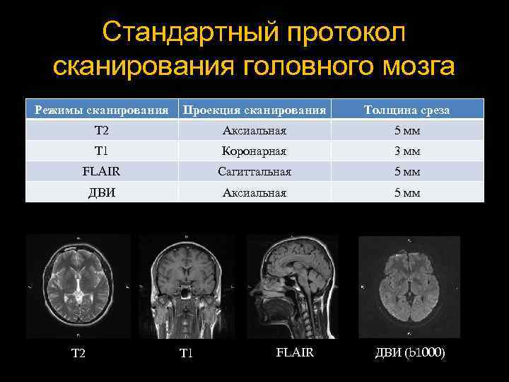 Стандартный протокол сканирования головного мозга Режимы сканирования Проекция сканирования Толщина среза Т 2 Аксиальная