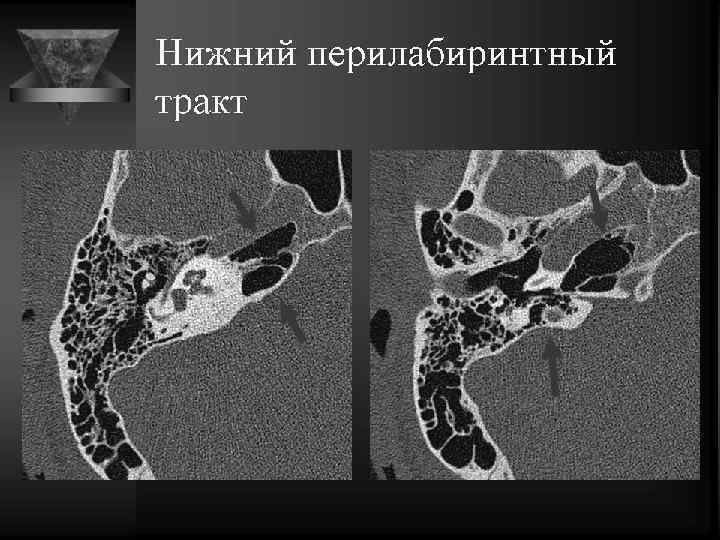 Мрт височных костей режимы