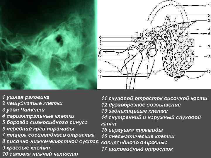 Кт височной кости москва