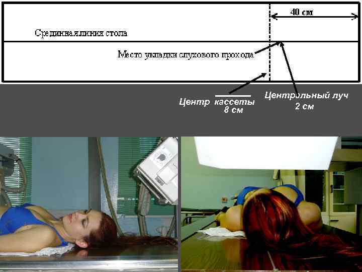 ____ Центр кассеты 8 см Центральный луч 2 см 