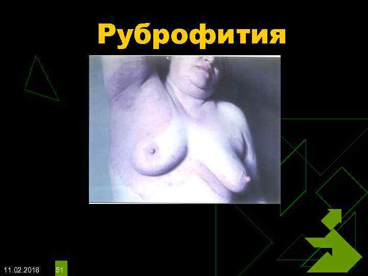 Руброфития 11. 02. 2018 51 