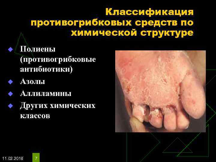 Классификация противогрибковых средств по химической структуре u u Полиены (противогрибковые антибиотики) Азолы Аллиламины Других