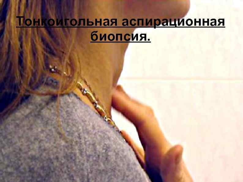 Тонкоигольная аспирационная биопсия. 