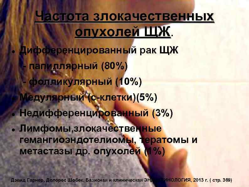 Частота злокачественных опухолей ЩЖ. ЩЖ Дифференцированный рак ЩЖ - папиллярный (80%) - фолликулярный (10%)