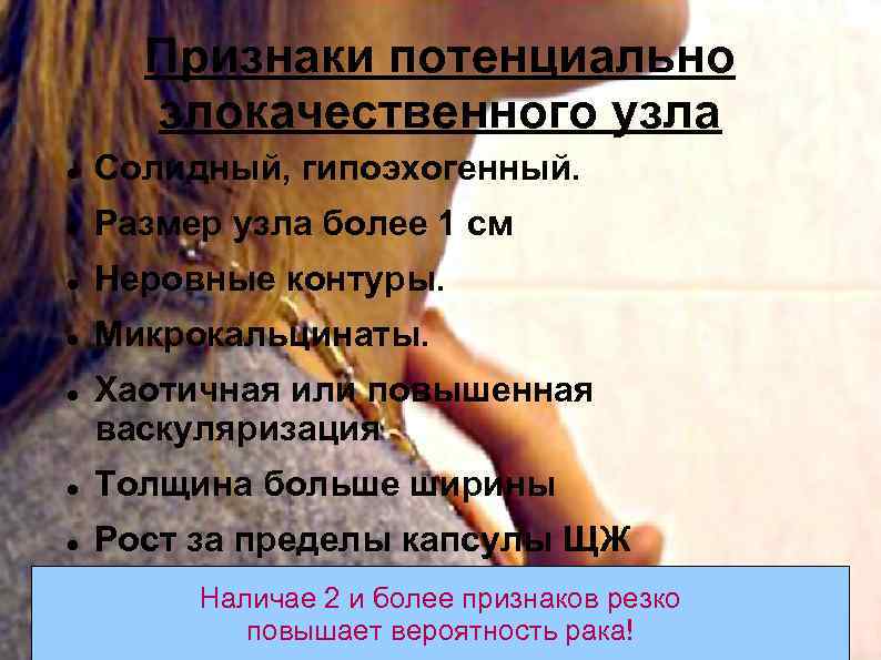 Признаки потенциально злокачественного узла Солидный, гипоэхогенный. Размер узла более 1 см Неровные контуры. Микрокальцинаты.