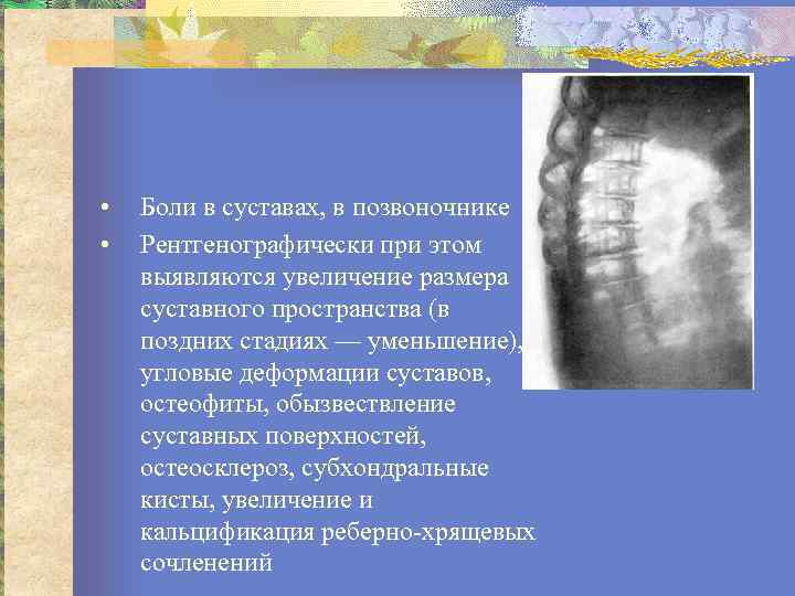  • • Боли в суставах, в позвоночнике Рентгенографически при этом выявляются увеличение размера