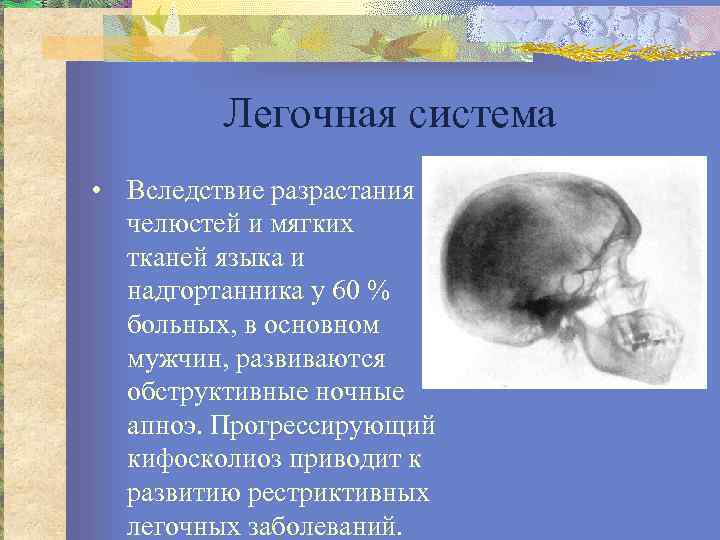 Легочная система • Вследствие разрастания челюстей и мягких тканей языка и надгортанника у 60