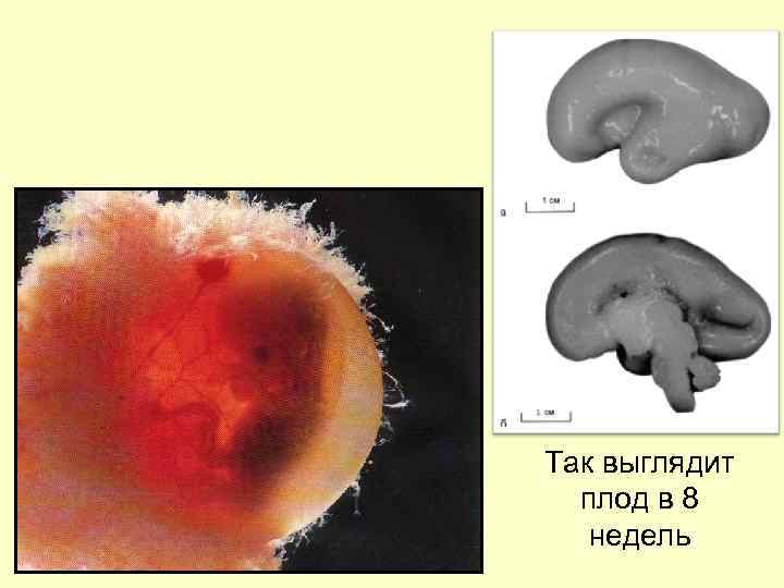 Так выглядит плод в 8 недель 