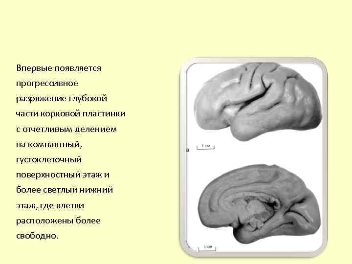 Впервые появляется прогрессивное разряжение глубокой части корковой пластинки с отчетливым делением на компактный, густоклеточный
