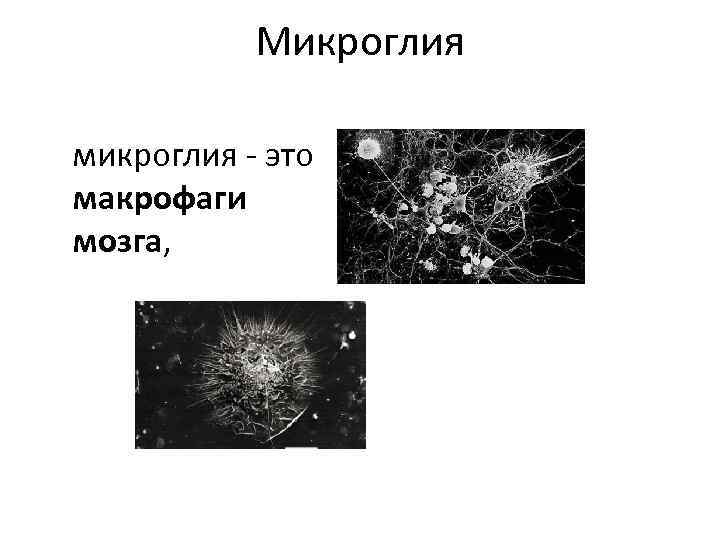 Микроглия микроглия - это макрофаги мозга, 
