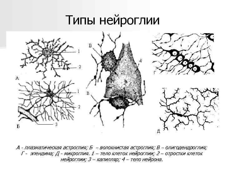 Типы нейроглии Г Д А - плазматическая астроглия; Б – волокнистая астроглия; В –