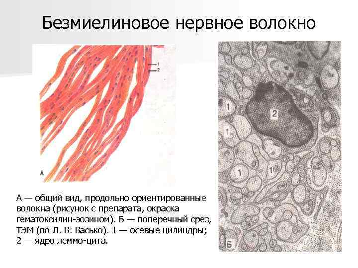 Безмиелиновое нервное волокно А — общий вид, продольно ориентированные волокна (рисунок с препарата, окраска