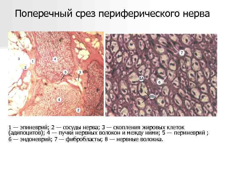 Поперечный срез периферического нерва 1 — эпиневрий; 2 — сосуды нерва; 3 — скопления