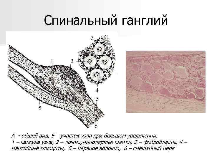 Спинальный ганглий А - общий вид, Б – участок узла при большом увеличении. 1