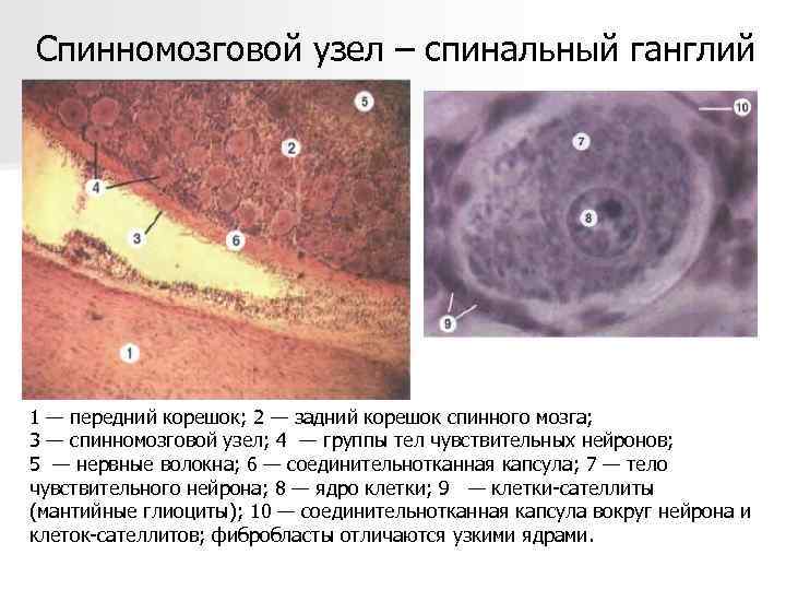 Спинномозговой узел рисунок