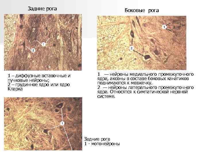 Задние рога 1 – диффузные вставочные и пучковые нейроны; 2 – грудинное ядро или