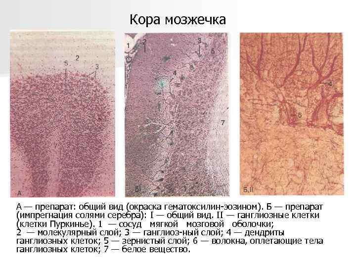 Кора мозжечка А — препарат: общий вид (окраска гематоксилин-эозином). Б — препарат (импрегнация солями