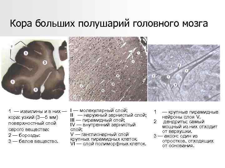 Кора больших полушарий головного мозга 1 — извилины и в них — кора: узкий