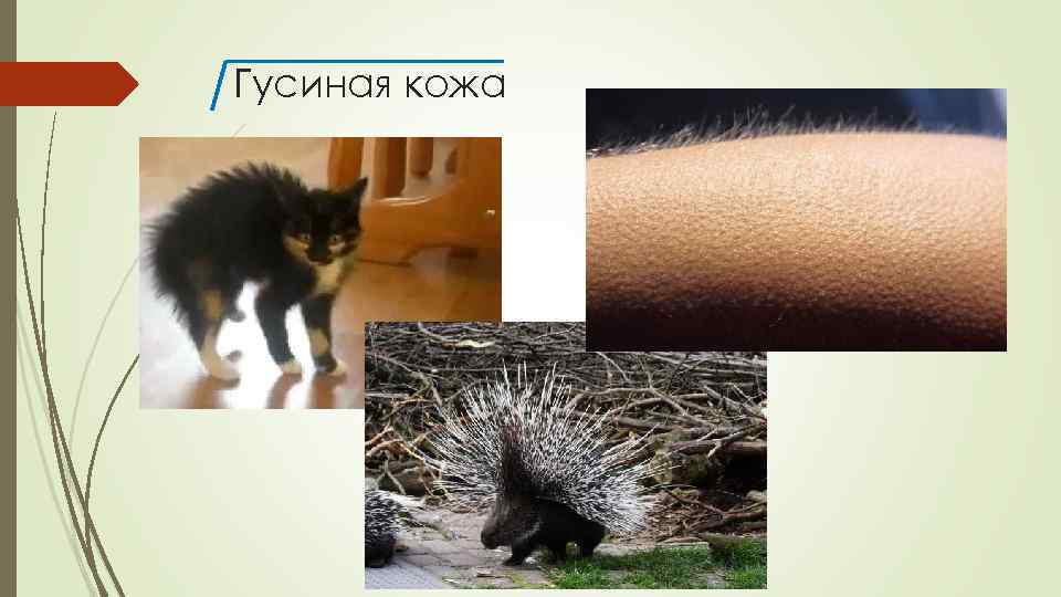 Гусиная кожа 
