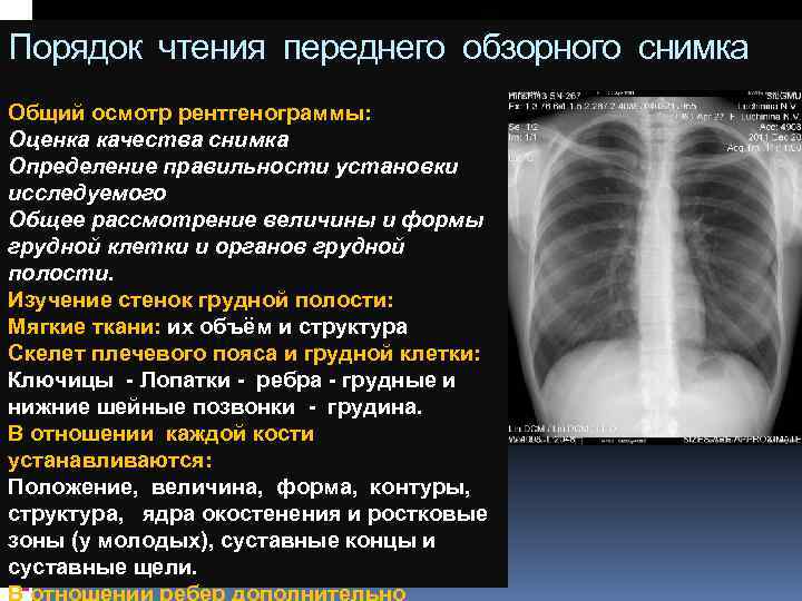 Как правильно рентген