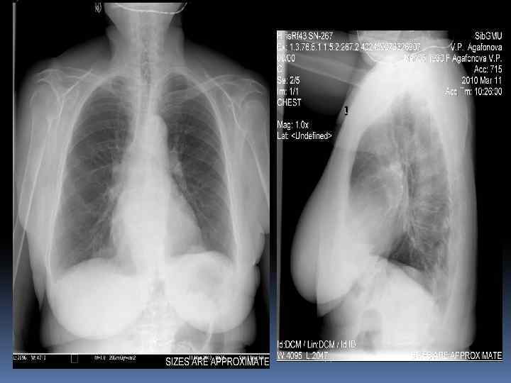 Мягкие ткани. 