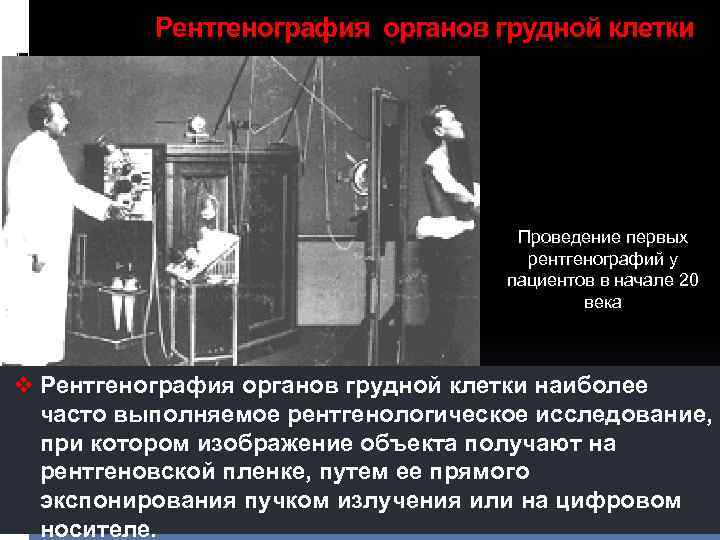 Рентгенография органов грудной клетки Проведение первых рентгенографий у пациентов в начале 20 века v