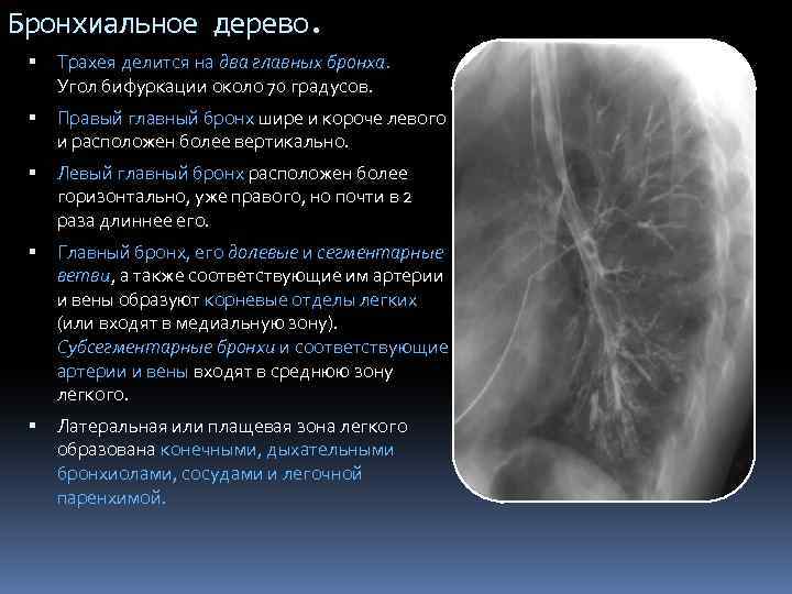 Бронхиальное дерево. Трахея делится на два главных бронха. Угол бифуркации около 70 градусов. Правый