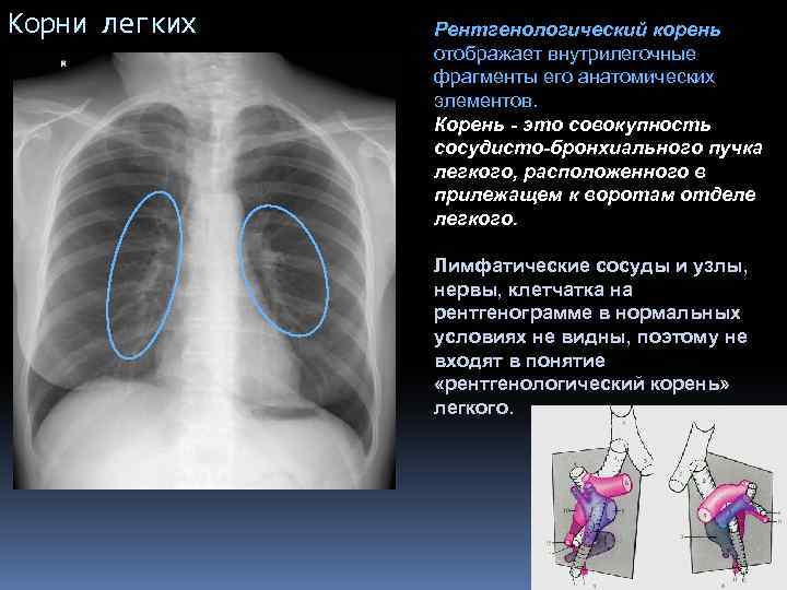 Расположены корень. Корень легкого анатомия. Анатомические структуры корня легкого. Структура корня легкого. Строение корня легкого.