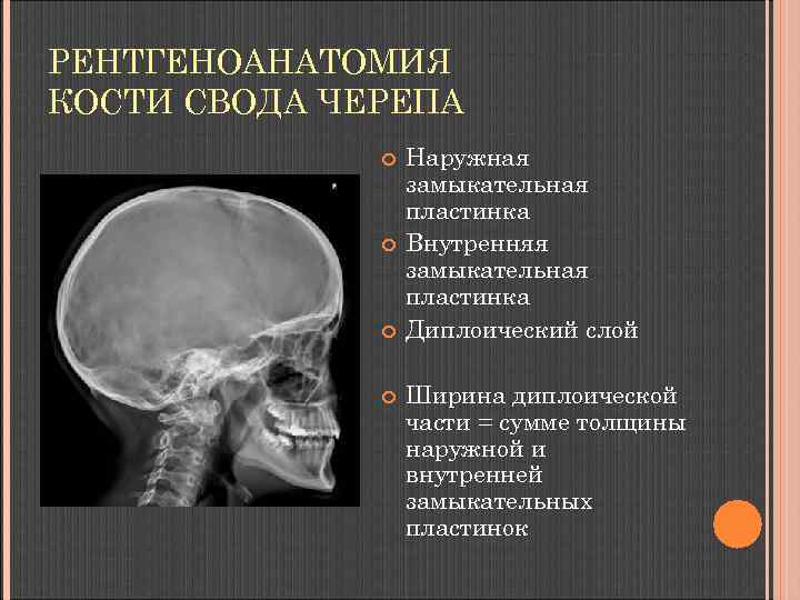 РЕНТГЕНОАНАТОМИЯ КОСТИ СВОДА ЧЕРЕПА Наружная замыкательная пластинка Внутренняя замыкательная пластинка Диплоический слой Ширина диплоической