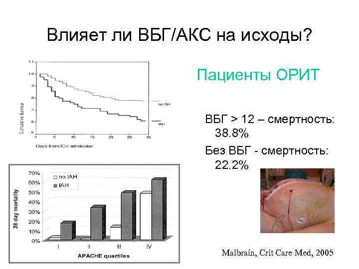 Влияет ли ВБГ/АКС на исходы? Пациенты ОРИТ ВБГ > 12 – смертность: 38. 8%