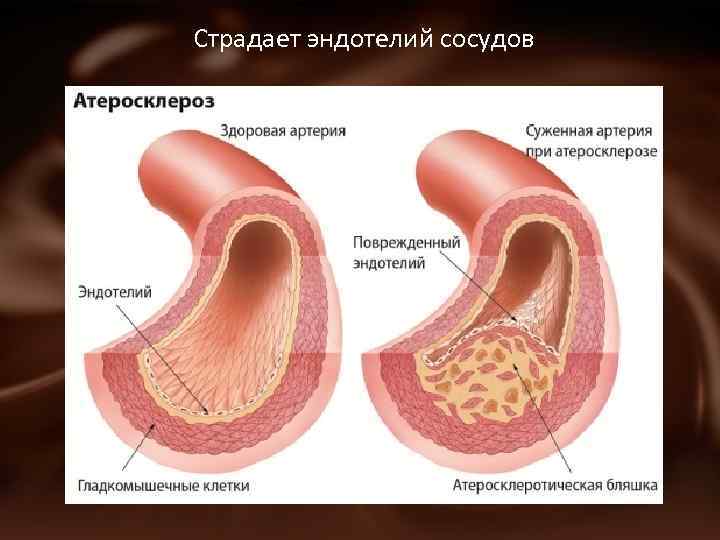 Страдает эндотелий сосудов 